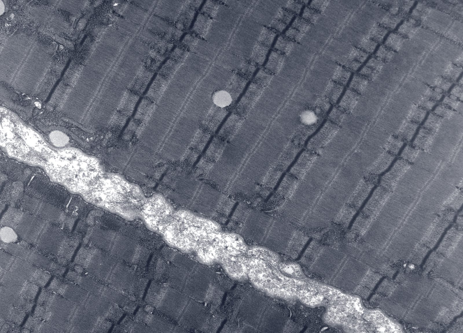 Black-and-white electron micrograph of human skeletal muscle cut along its length. Fibres run diagonally across the frame, crossed at regular intervals by dark transverse lines with a granular band along each. A pale, irregular band runs between two groups of fibres.