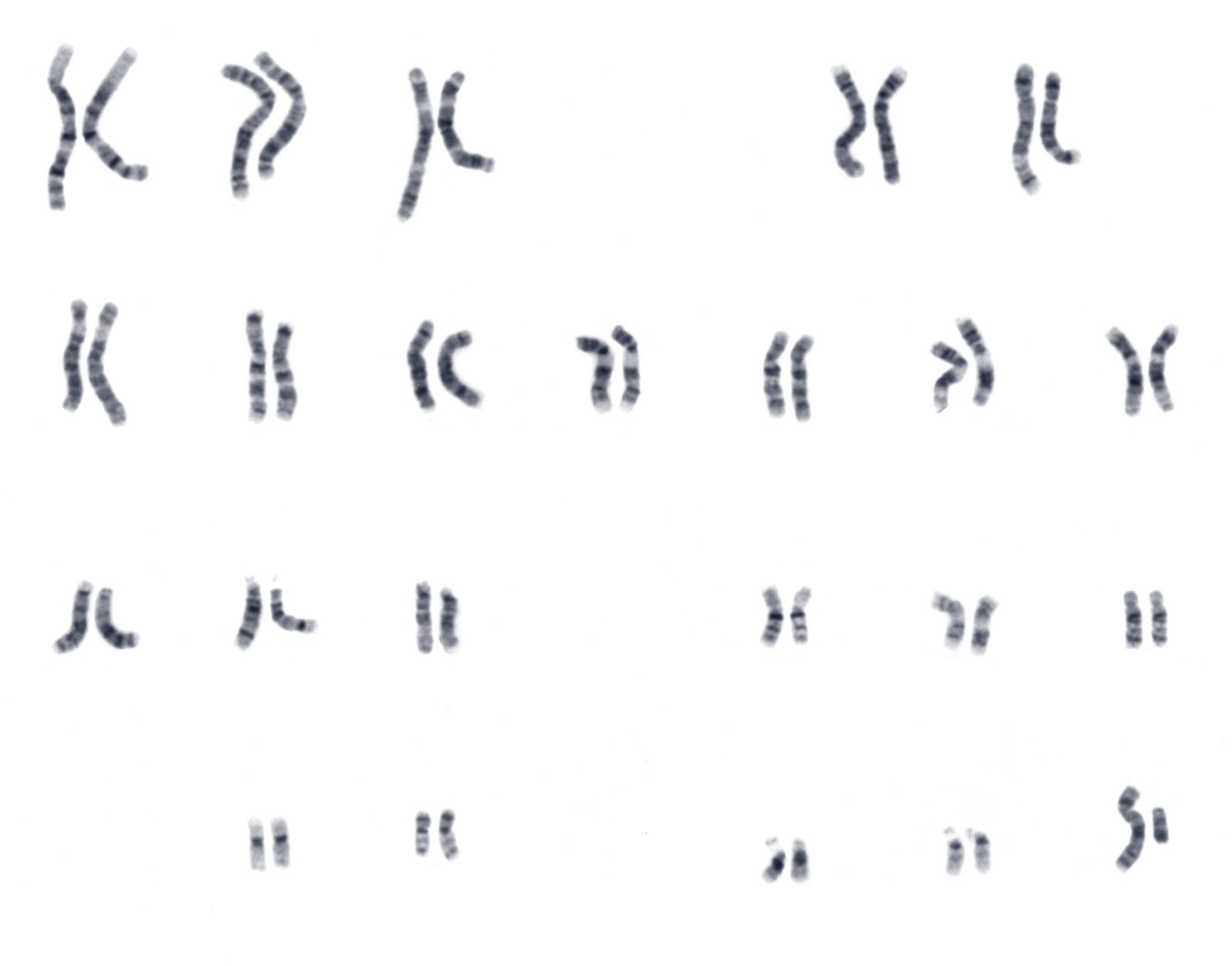 A human male karyotype: the chromosomes of one cell photographed under a microscope, each stained in light and dark bands, arranged in pairs from the largest to the smallest.